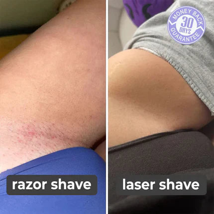 Laser Hair Remover (90% OFF TODAY ONLY!)