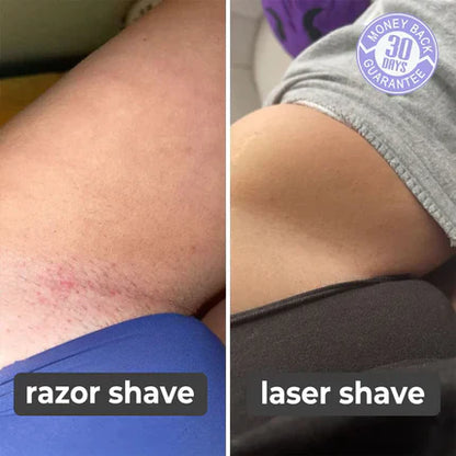 Laser Hair Remover (90% OFF TODAY ONLY!)